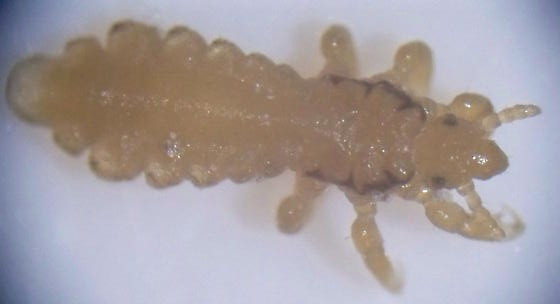 Head Louse photo by Jerrod Johnson, http://bugguide.net/node/view/176539